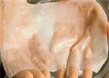 استفاده از پرده آمنیوتیک جنین برای ترمیم پوست دست بیماران eb