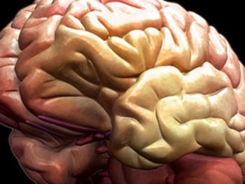 ژن جدید سکته مغزی کشف شد
