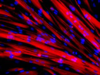 پیوند سلول های بنیادی بیماران مبتلا به دیستروفی عضلانی به موش