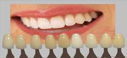 پرورش دندان‌هاي طبيعي با سلول های بنيادي!