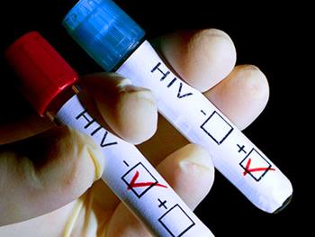 آنتی بادی های مونوکلونال، مؤثر در درمان HIV