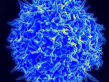 شناسایی سلول های ایمنی که به رشد سرطان کمک می کنند