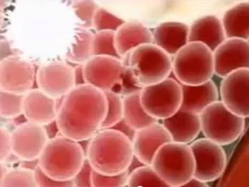 درمان ریفلاکس نفروپاتی با استفاده از سلول های بنیادی نشان دار با نانوذره  های مغناطیسی