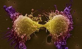 انواع متفاوت سلولی در سرطان پروستات 