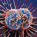 تغییرات اپی ژنتیکی عامل تبدیل سرطانی شدن سلول های سالم معده