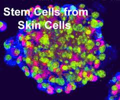 بازبرنامه ریزی مستقیم سلول های پوست انسانی به سلول های مغز