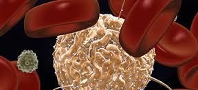 پیوند سلول های بنیادی خون ساز آلوژن برای بیماران مبتلا به لوکمیای میلوئید مزمن بعد از تیمار با مهارکننده های تیروزین کینازی