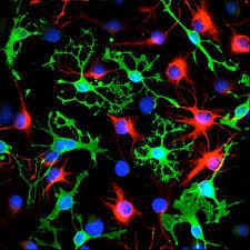 یافتن راهی برای مونیتور کردن پیشرفت سلول های بنیادی بعد از پیوند به مغز