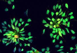 تولید نورون های هیپوتالاموسی که به هدف قرار دادن برخی بیماری ها کمک می کنند