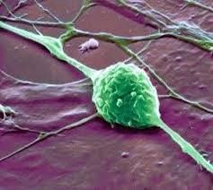 مطالعه ای جدید درک بهتری را در مورد چگونگی تبدیل سلول های بنیادی به تومور ارائه می دهد