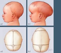 سلول های بنیادی که نواقص تولد را مهار می کنند روی ترمیم آسیب های چهره ای نیز اثر می گذارند