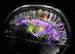 شناسایی مکانیسم تشکیل  شبکه های عصبی پیچیده مغز در درمان بیمارهای عصبی