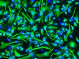 کشف سلول های درخشان(سلول  های بنیادی سرطانی حاوی ویتامین B)  که مسئول ایجاد تومورها هستند