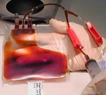 بانک خون بندناف یک ذخیره بسیار خوب  برای تضمین سلامت جامعه است