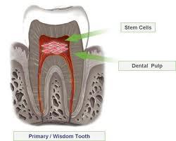 استفاده از سلول های بنیادی پالپ دندان برای بهبود بقا و ترمیم سلول های شبکیه 