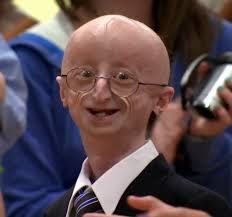 استفاده از سلول های بنیادی پرتوان القا شده برای شناسایی مکانیسم های دخیل در بیماری Progeria(پیری زودرس در کودکان)