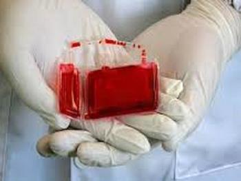 اثر ذخیره سازی واحدهای خون بند ناف با دوز سلولی بالا روی بیماران با قومیت های مختلف