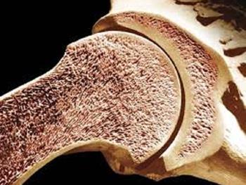 ایمپلنت های پرینت شده سه بعدی به رشد استخوان واقعی کمک می کند