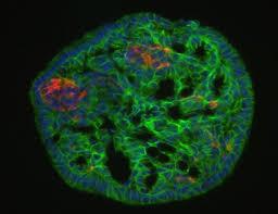 رشد سلول های بنیادی پانکراسی برای تحقیقات دیابت