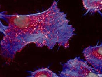 سلول های سرطانی می توانند راه خود را از میان بافتهای بدن با هول دادن پیدا کنند