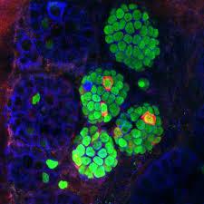 تبدیل سلول های بنیادی به سلول های تولید کننده انسولین
