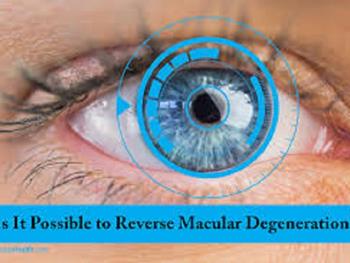 تخریب یا دژنراسیون ماکولا: نتایج امیدوار کننده از سلول های بنیادی