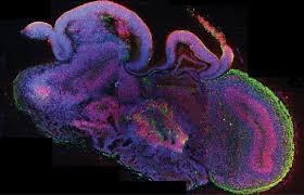 ارگانوئیدها دیدگاه های جدیدی را در مورد تکوین مغز ما ایجاد کرده اند