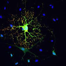 سوئچی اصلی برای میلین سازی در سلول های بنیادی مغزی