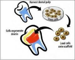 سلول های بنیادی دندان می توانند درمانی برای بیماران با مشکلات دندانی باشند