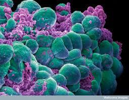 سیستم کشت سلول می تواند در زمینه سرطان موفقیت به ارمغان بیاورد