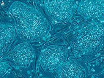 روشی جدید برای تبدیل سلول های پوستی به سلول های بنیادی پرتوان