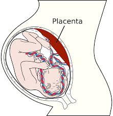ارتباط جفت و چاقی مادری در مراحل اولیه بارداری