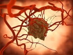 سلول هایی که عروق خونی را می سازند می توانند تومورها را نیز بسازند و به پراکنش آن ها کمک کنند