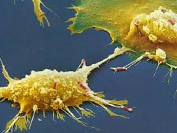 سفتی بافت نقطه قوتی برای زنده ماندن سلول های سرطانی عمل می کند