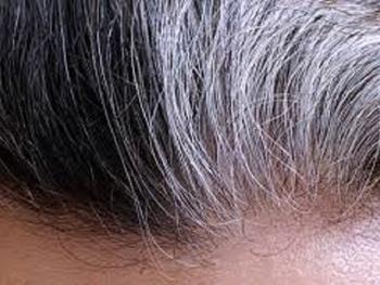 ارتباط موی خاکستری برای فعالیت سیستم ایمنی و عفونت ویروسی