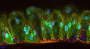 سلول های بنیادی پیر روده در ظروف آزمایشگاهی مانند سلول های بنیادی جوان رشد می کنند