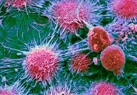 سلول های بنیادی برای مقابله با تومورها