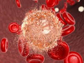 سلول های بنیادی سرطانی، بوسیله غیر فعال کردن تشخیص دهنده خطر سیستم ایمنی بدن را دور می زنند