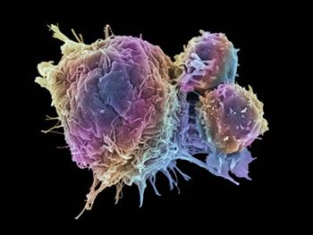 کشتن سلول های بنیادی سرطانی نامیرا