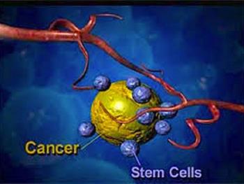 عود مجدد سرطان به سلول های بنیادی بستگی دارد