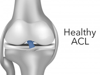 شناسایی یک رویکرد بازسازی کننده برای تقویت ACL