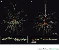 می توان نورون های پیر شده را با استفاده از تکنولوژی سلول های بنیادی تولید کرد