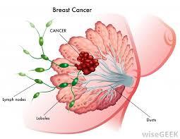 چگونه Frizzled7 می تواند چگونگی تکوین سرطان سینه را آشکار سازد؟