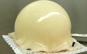 استفاده از بافندگی سه بعدی برای رشد جایگزین مفصل ران