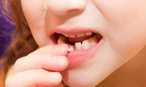 سلول های بنیادی دندانی می توانند انقلابی در درمان بیمارانی باشند که دچار ضایعات چهره ای شده اند