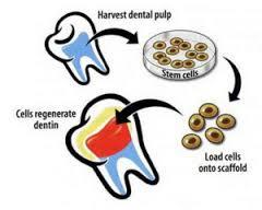 چگونه سلول های بنیادی موجود در دندان شما، زندگی شما را نجات می دهد