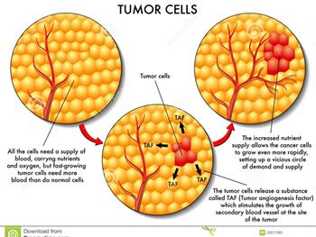 محققان  مشخص کردند که چگونه منبع سلول های سرطانی خصوصیات تهاجمی و متاستاز سلول های تومور را کنترل می کند.