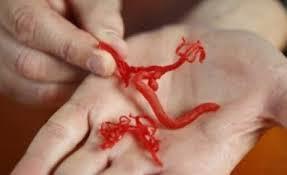 تولید گرافت های بسیار کوچک از عروق خونی زیست مهندسی شده برای ترمیم جراحی بافت های آسیب دیده