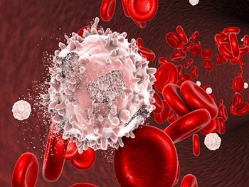یک گام نزدیک‌تر به درمان سرطان خون در بزرگسالان به کمک سلول‌های CAR-T