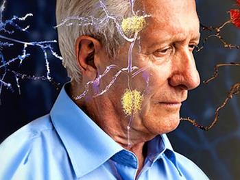 بررسی پروتئین های التهابی به تشخیص زود هنگام بیماری آلزایمر کمک می کند